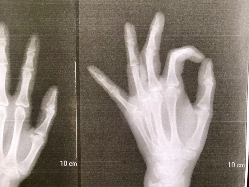 Ветер перемен или Манила заманила.