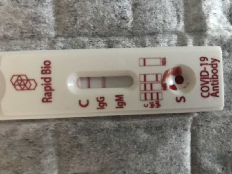 Анализ на антитела к коронавирусу